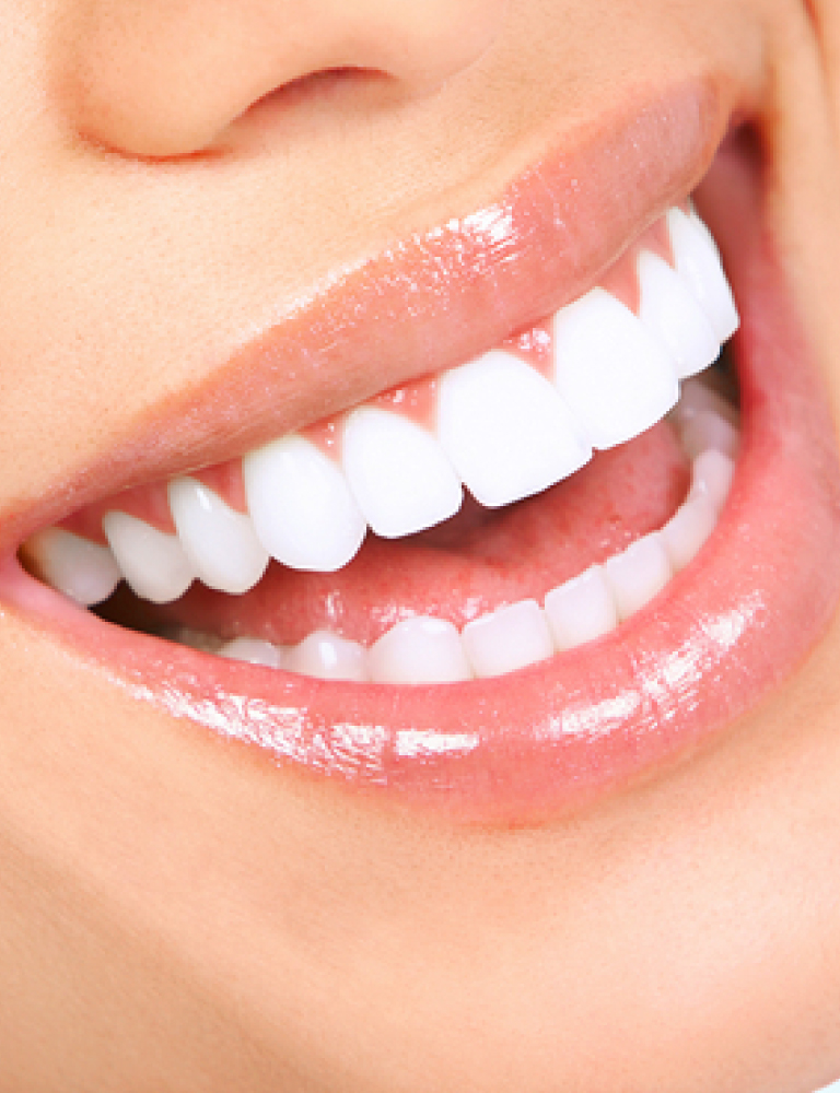 WHEN SHOULD I GET DENTAL CROWNS?